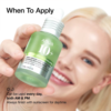 Azelaic Acid 10 Hyaluron Redness Soothing Serum