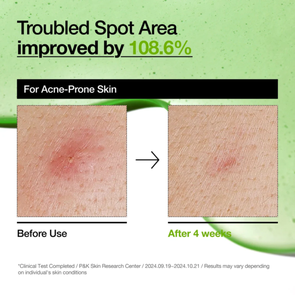 Azelaic Acid 10 Hyaluron Redness Soothing Serum